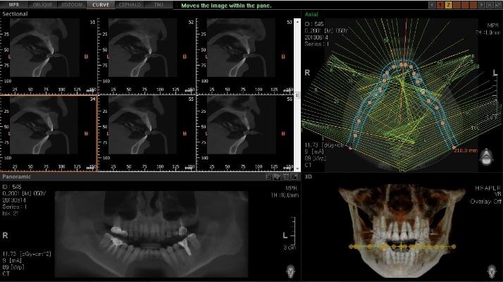Pax-i 3D Green - Tomografía