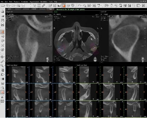 Pax-i 3D Green - ATM (TMJ)