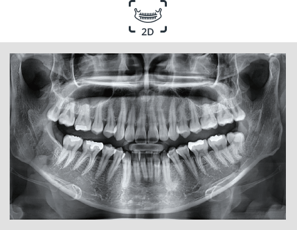 Pax-i 3D Smart - Imagen Auto Pano