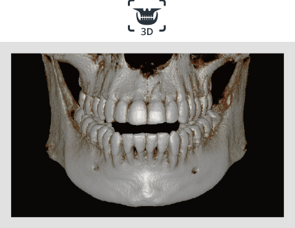 Pax-i 3D Smart - Imagen CT