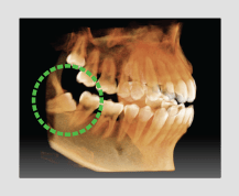 Pax-i 3D Smart- Imagen volumen en forma de arco