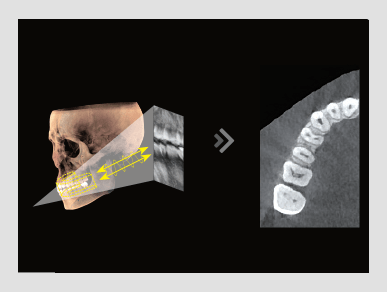 Pax-i 3D Smart - Reconstrucción de Imagen Smart