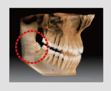 Pax-i 3D Smart- Imagen volumen en forma de arco