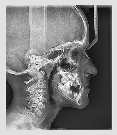 Radiografía LATERAL