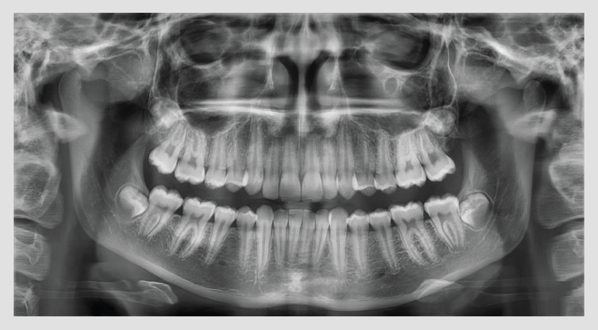 Radiografía Panorámica