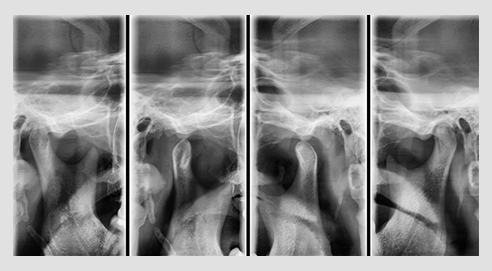 Radiografía Modo TJM