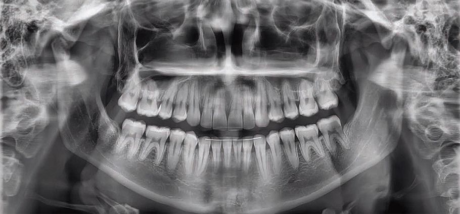 Radiografía Panorámica