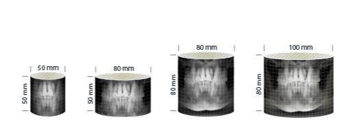 Pax-i 3D Green Comparativa tamaños de FOV 5x5, 5x8, 8x8, 8x10
