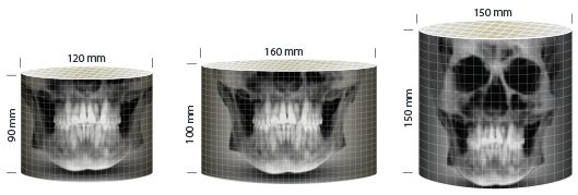 Pax-i 3D Green Comparativa tamaños de FOV 9x12, 10x16, 15x15