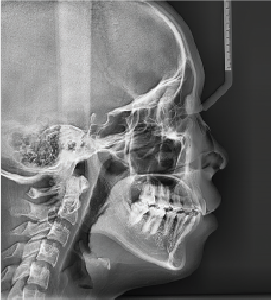 Radiografía Cefalométrica Mediana