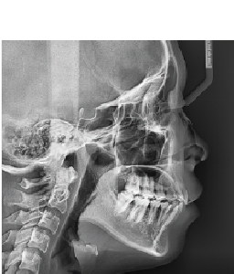 Radiografía Cefalométrica Pequeña
